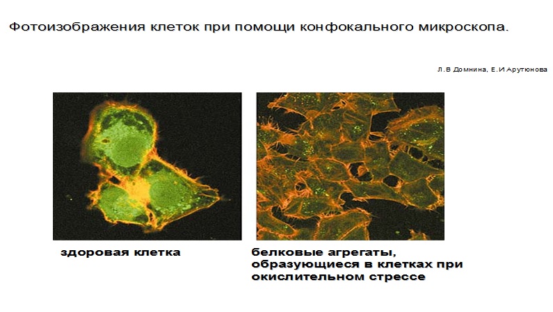Здоровая клетка и белковые агрегаты, образующиеся в клетках при окислительном процессе