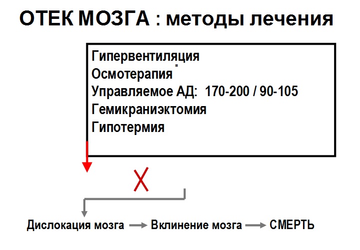 Отек мозга, методы лечения