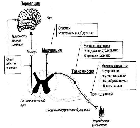 Многоуровневая антиноцицептивная защита