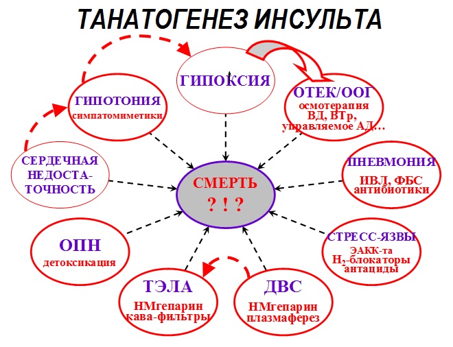 Танатогенез инсульта