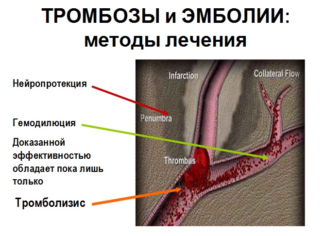 Тромбозы и эмболии